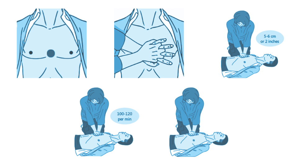 how_to_give_chest_compressions